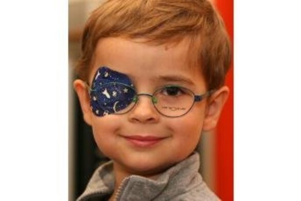 Zkušenosti s okluzí, s druhy okluzoru a s jejich snadným sundáváním